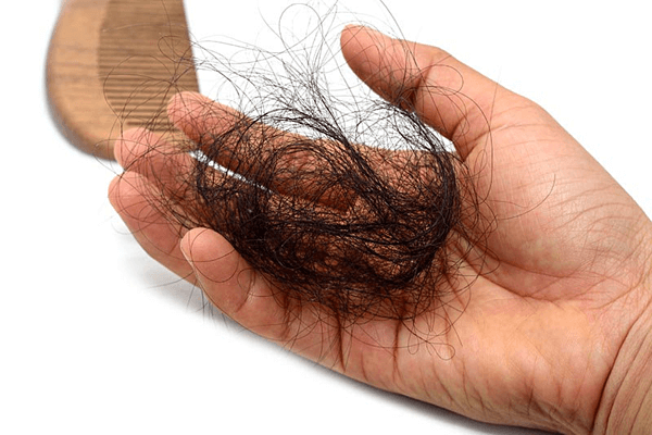Bệnh rụng tóc là gì?