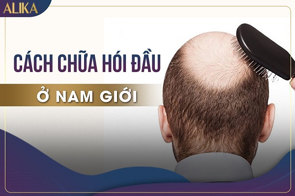 Rụng tóc nam giới: Nguyên nhân và cách điều trị, phòng ngừa